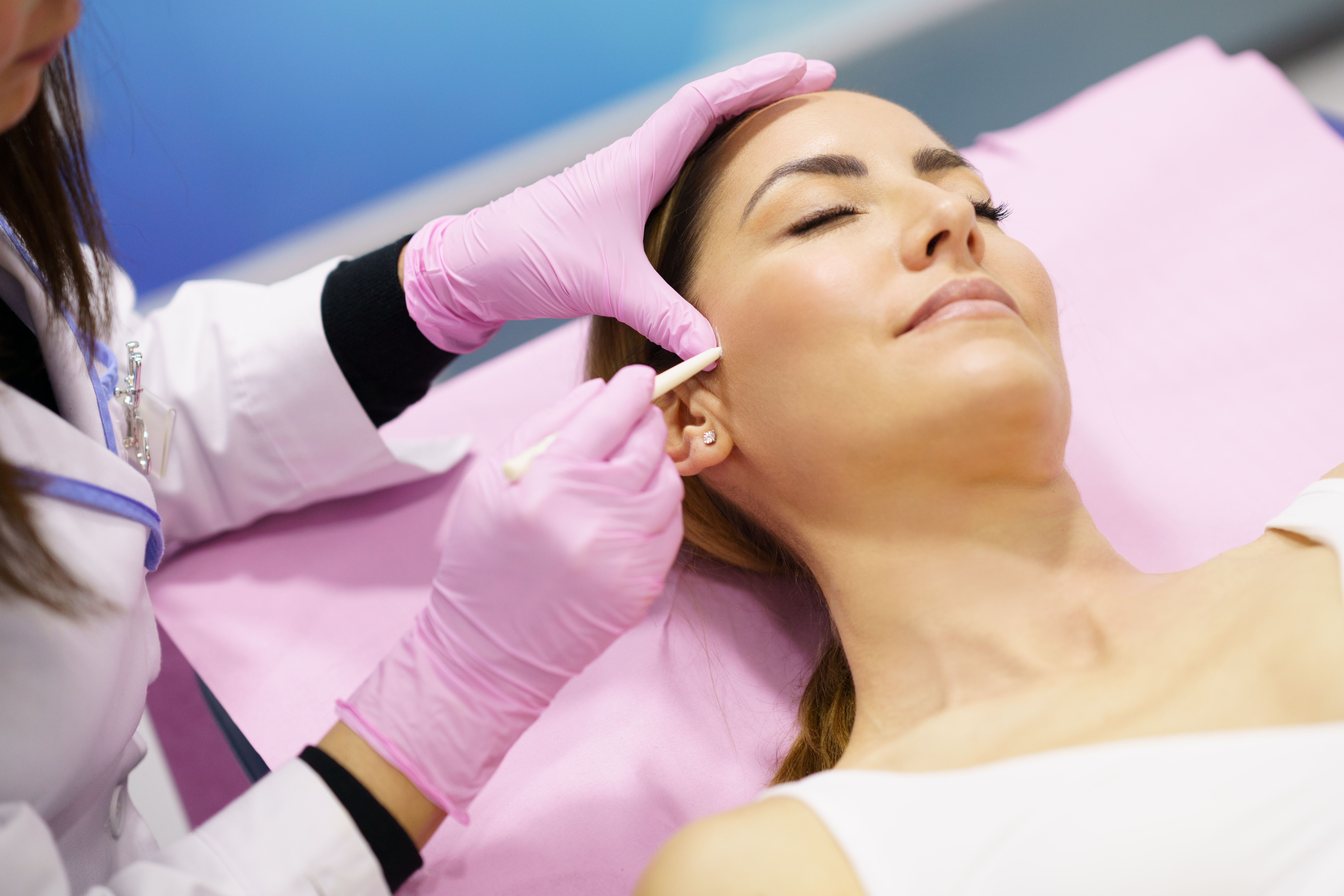 Doctor painting the area of a woman's face where the PDO suture treatment threads will be