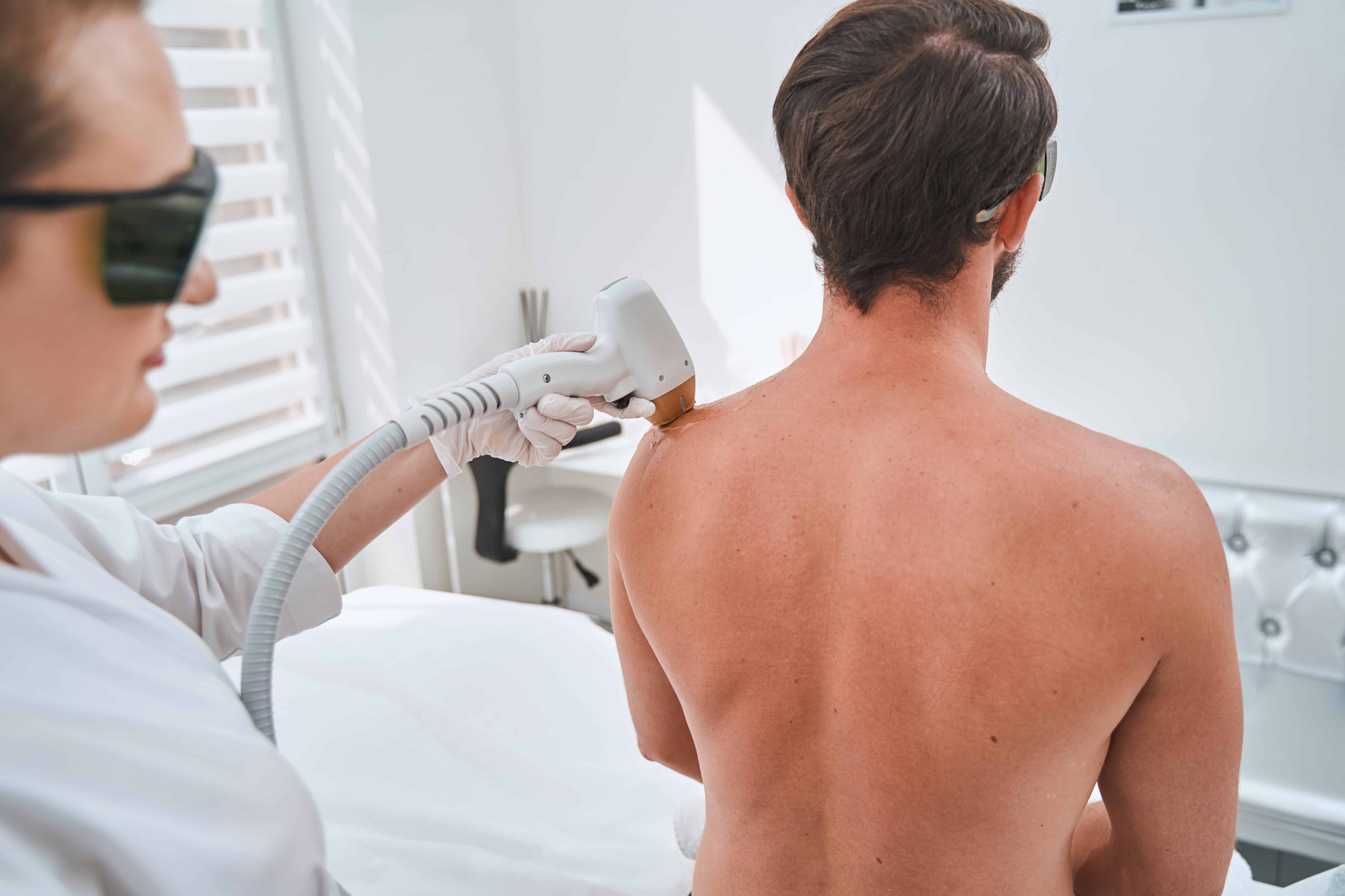 Spa client undergoing a shoulder laser hair removal