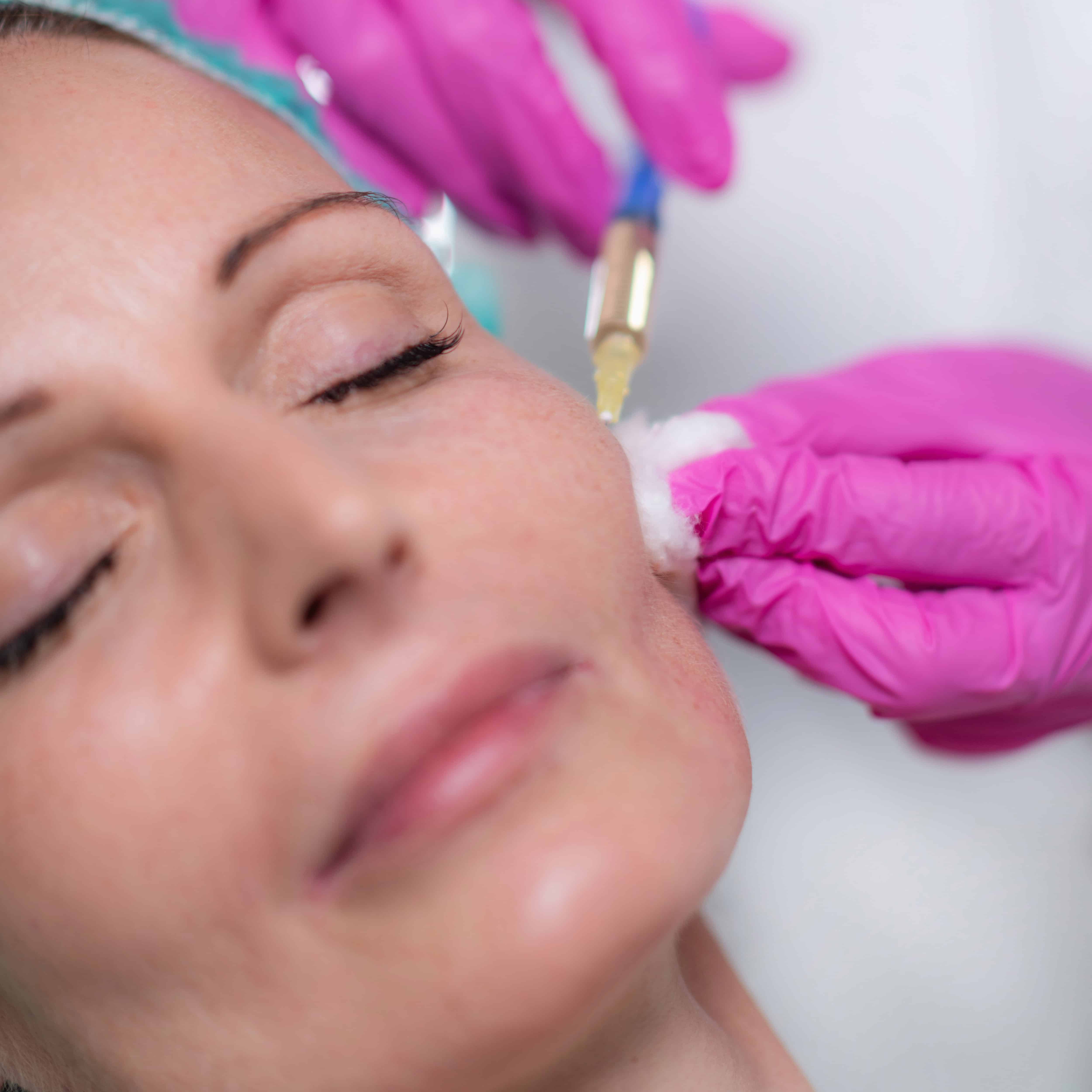 Hyaluronic Acid Injection Fillers for Cheeks