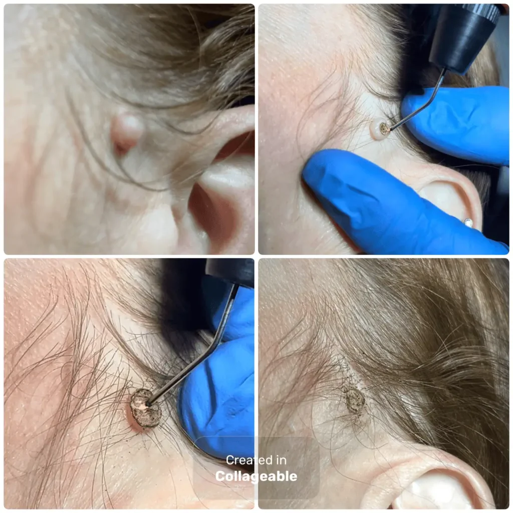 Natural Radiance PLASMAGE® in Scottsdale, AZ