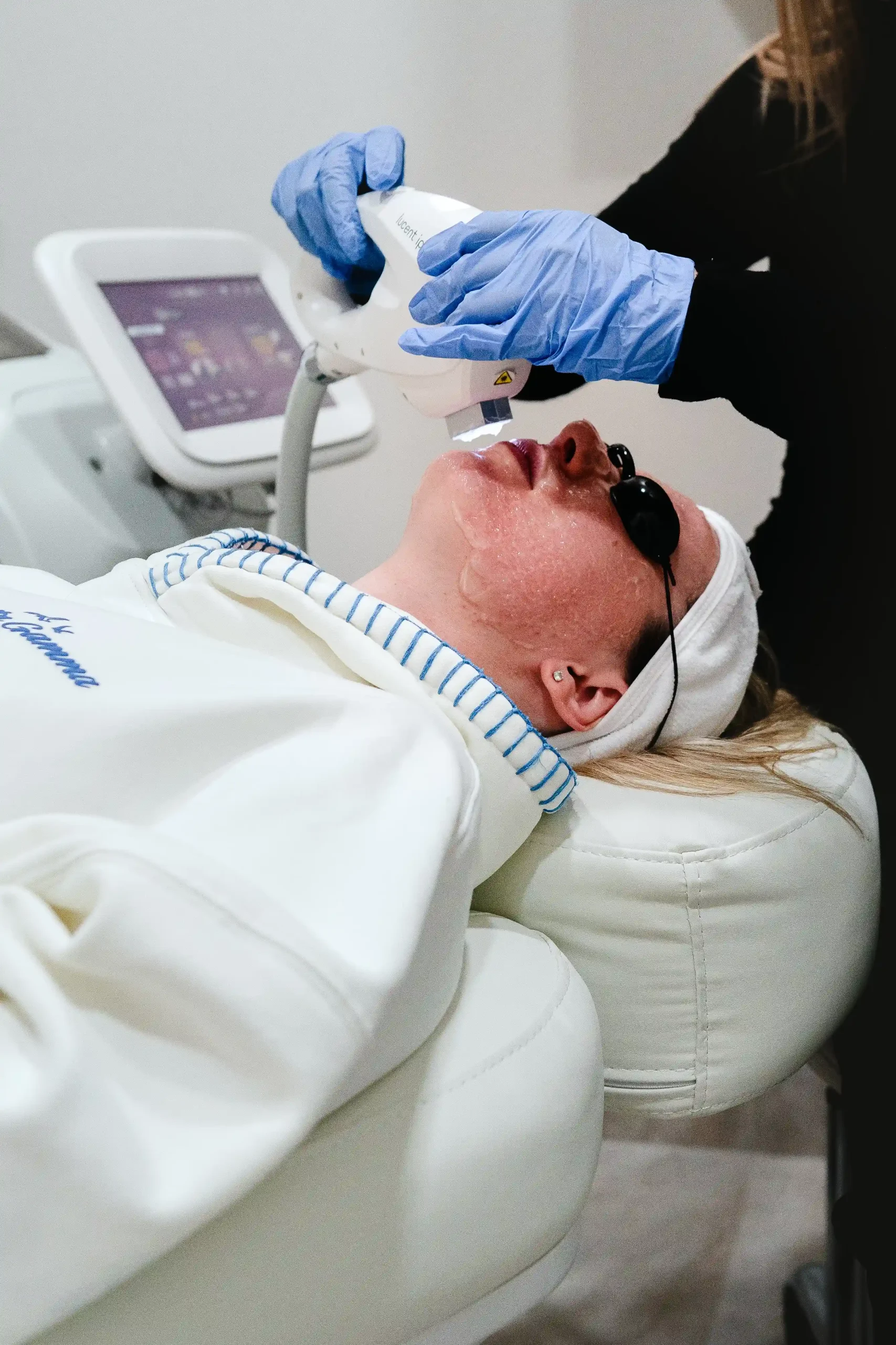IPL Photofacial 2