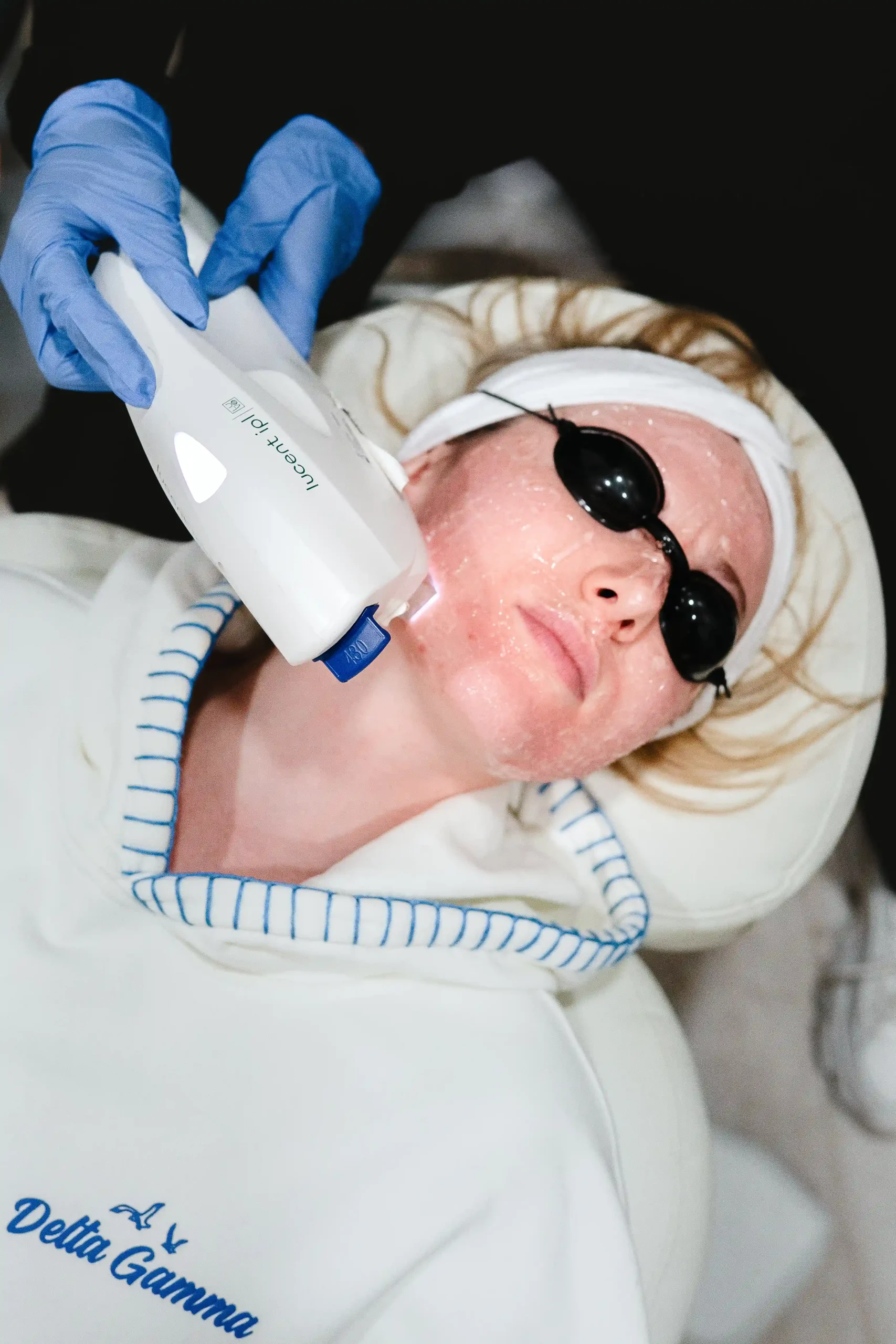 IPL Photofacial 4