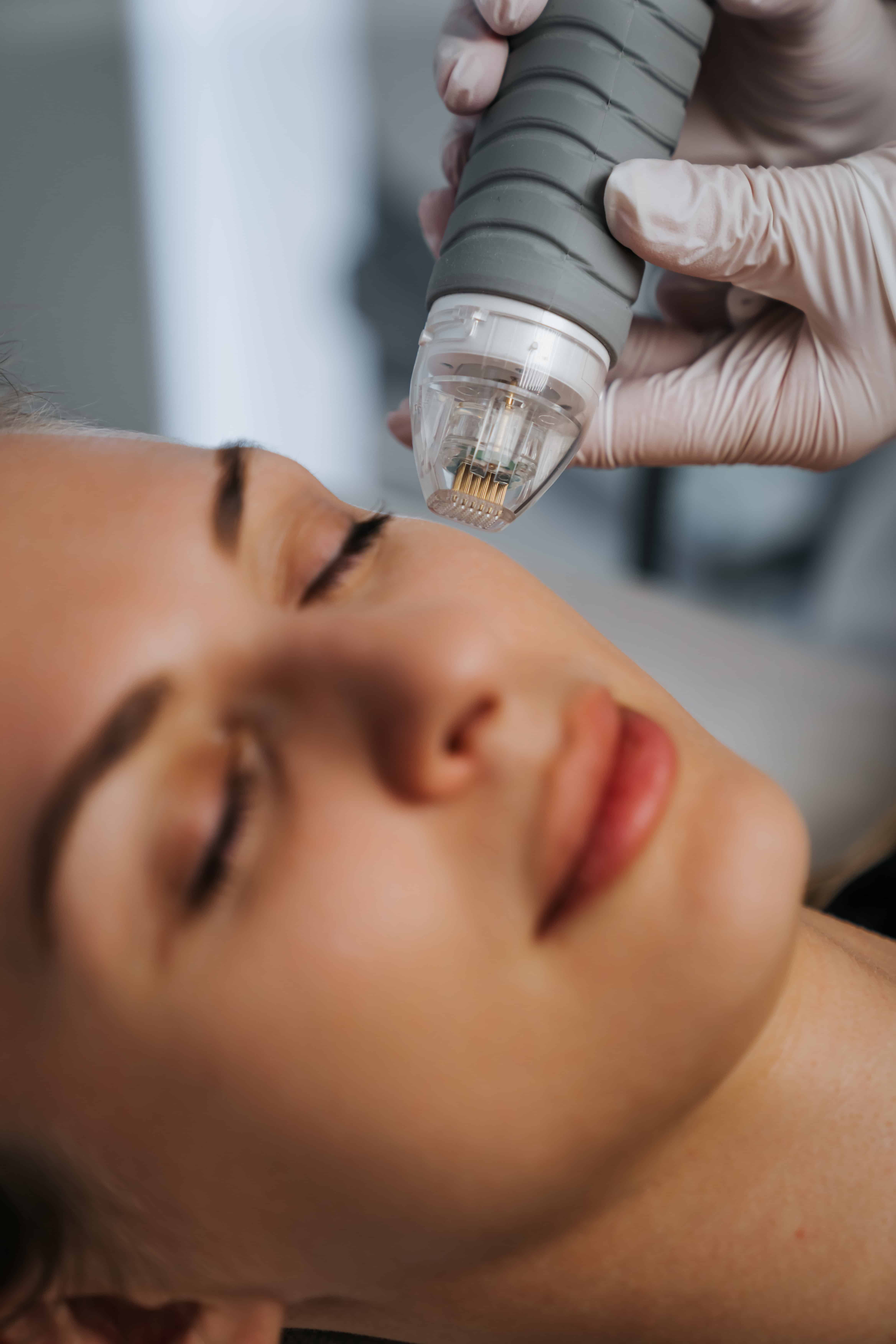 Microneedle RF lifting in a beauty salon. Big plan.
