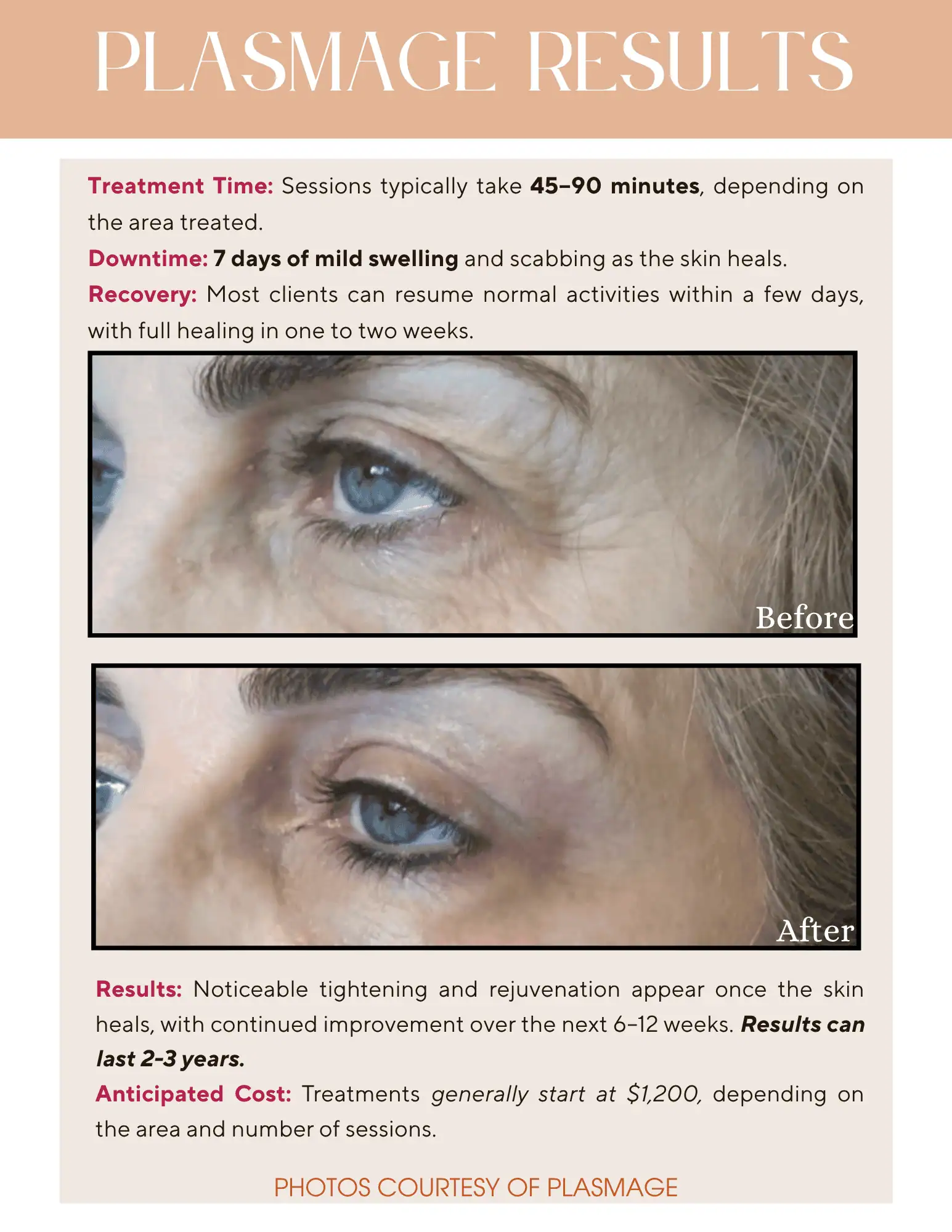 Plasmage Results